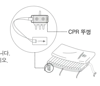 CPR 뚜껑 위치